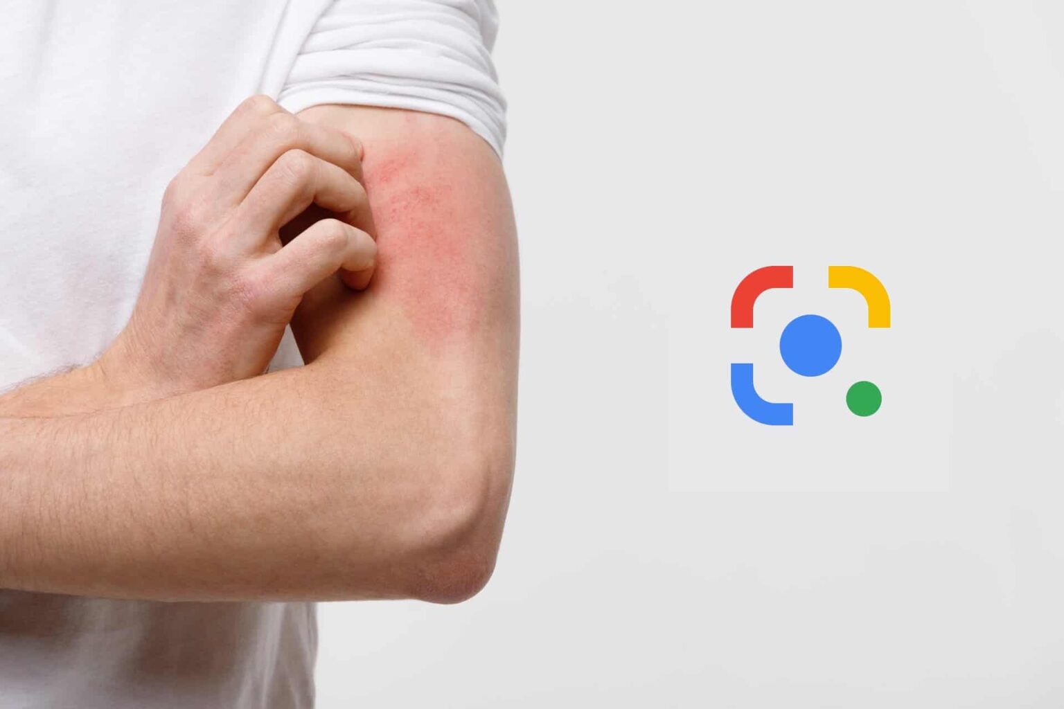 Braço de homem de camiseta branca coçando área avermelhada na pele, ao lado do logo do Google Lens