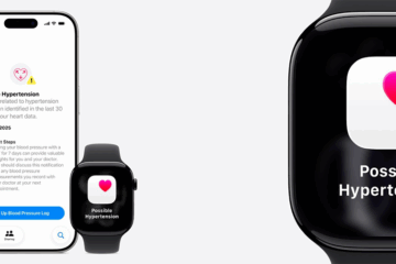 Apple Watch Series 11