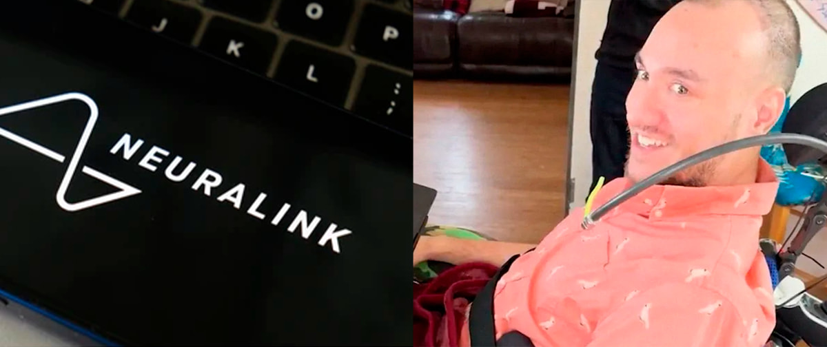 “Neuralink mudou minha vida”: o que conta o primeiro paciente com chip no cérebro da empresa de Elon Musk