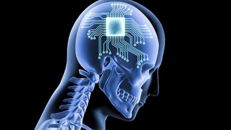 A Neuralink, de Elon Musk, fará testes de implantação de chips em humanos