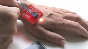 Homem que já tem mais de 30 implantes instala microchip no corpo para pagamento com a mão