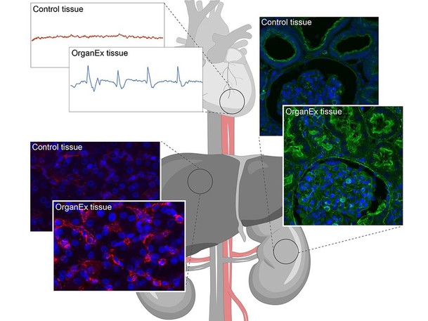 OrganEx